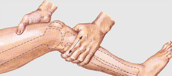 Lachmann Test