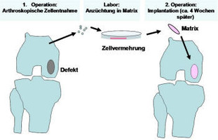 ACT schematische Darstellung