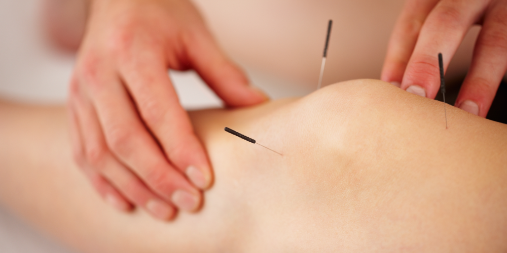 Akupunktur im Knie